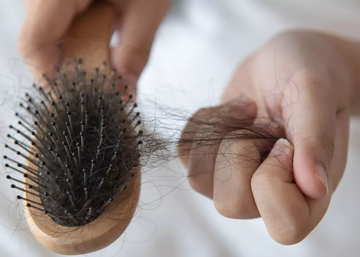 Rambut Rontok: Masalah yang Sering Menghantui Wanita, Solusi Apa yang Tepat?