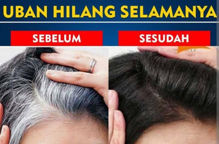 3 Minyak Terbaik untuk Rambut Tebal dan Sehat: Rahasia Rambut Indah Alami