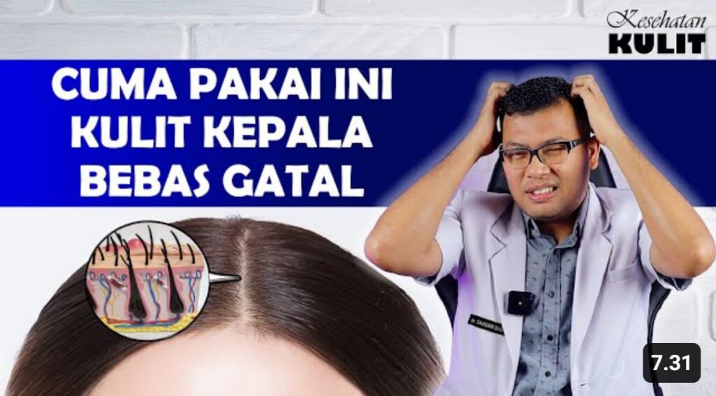 Gatal di Kepala Bikin Stres? Atasi dengan Cara Alami Ini!