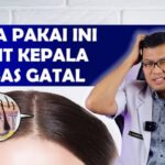 Gatal di Kepala Bikin Stres? Atasi dengan Cara Alami Ini!