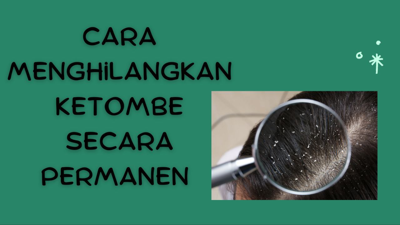 Cara Menghilangkan Ketombe dengan Cepat: 12 Tips Efektif untuk Hasil Maksimal