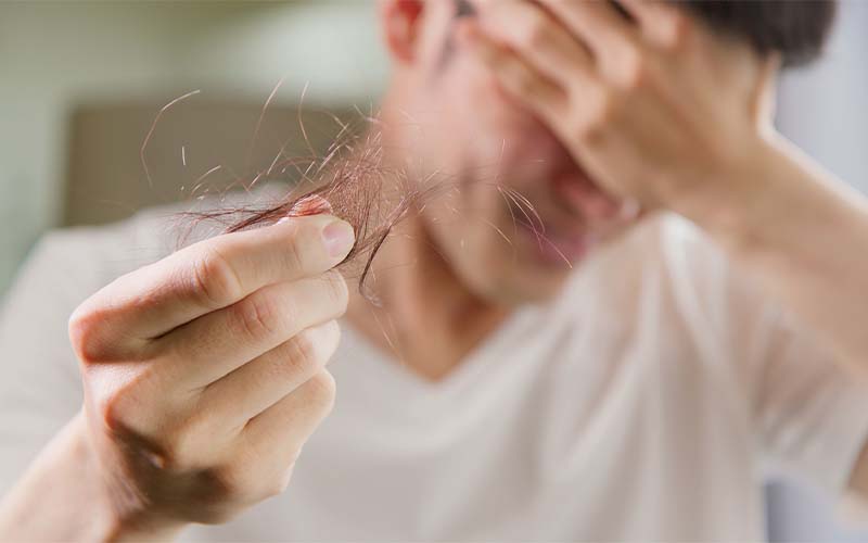 Rambut Rontok yang Tak Terduga: Bisakah Alergi Makanan Jadi Biang Keladinya?