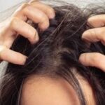 Kulit Kepala Gatal dan Rambut Berminyak? Tenang, Ada Solusinya!