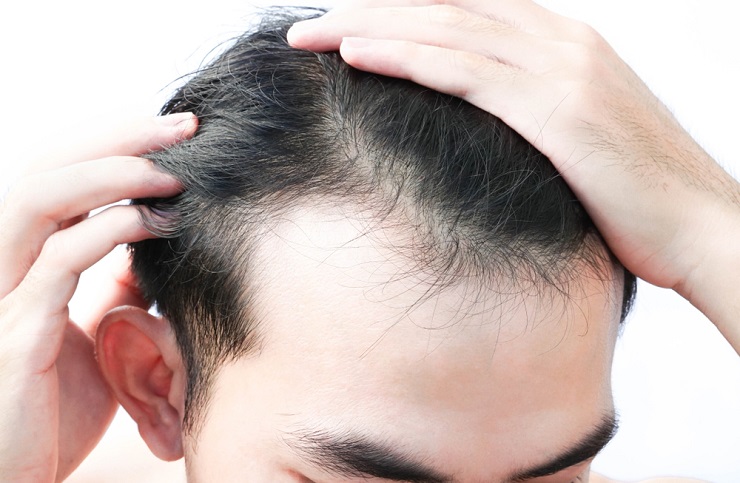 Rambut: Fisik atau Bukan? Sebuah Perjalanan Menelusuri Batas-Batas Definisi