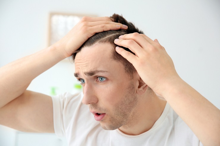 Rambut Rontok Tak Kunjung Padam? Bisa Jadi Infeksi Kulit Kepala Biang Keladinya!