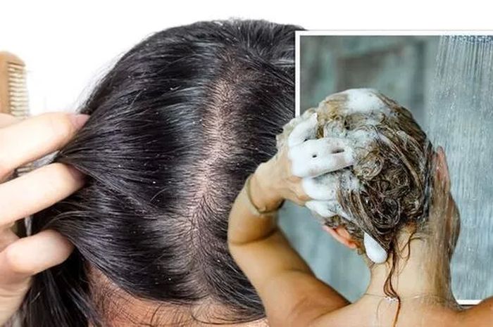 Gatal Tak Kunjung Reda, Rambut Rontok Tak Terkendali? Kenali Penyebabnya dan Atasi Sekarang!