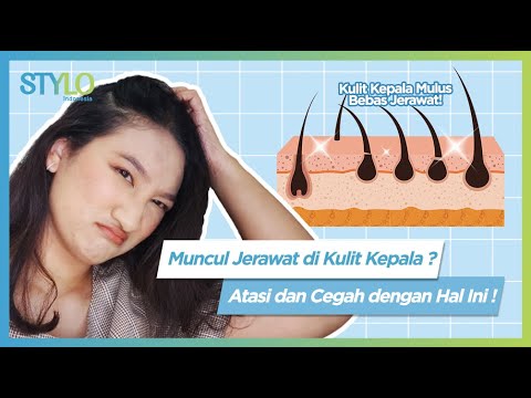 Cara Mengatasi Kulit Kepala Gatal dan Berbau: 12 Langkah untuk Kulit Kepala Segar dan Sehat