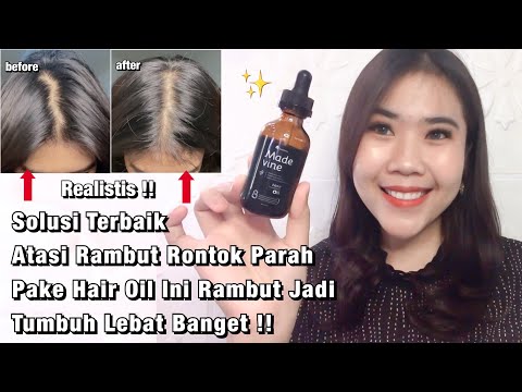 Rambut Kering dan Rontok Parah? Atasi dengan Minyak Esensial!