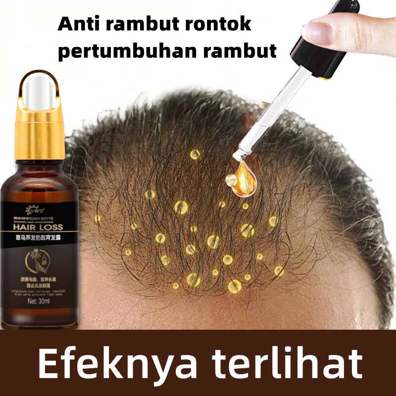 Obat Penumbuh Rambut Rontok: 12 Produk yang Terbukti Efektif untuk Pertumbuhan Rambut