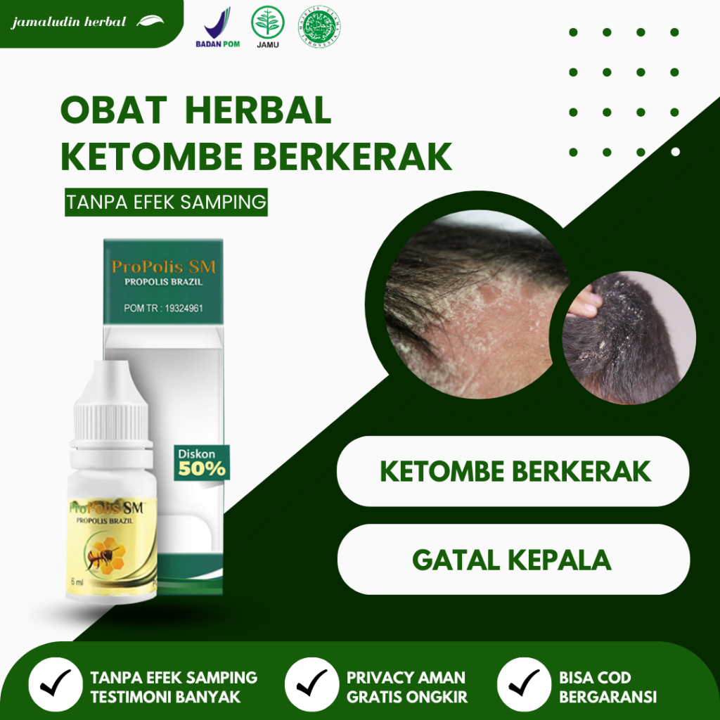 Produk Anti Ketombe Terbaik: 12 Rekomendasi untuk Kulit Kepala Sehat