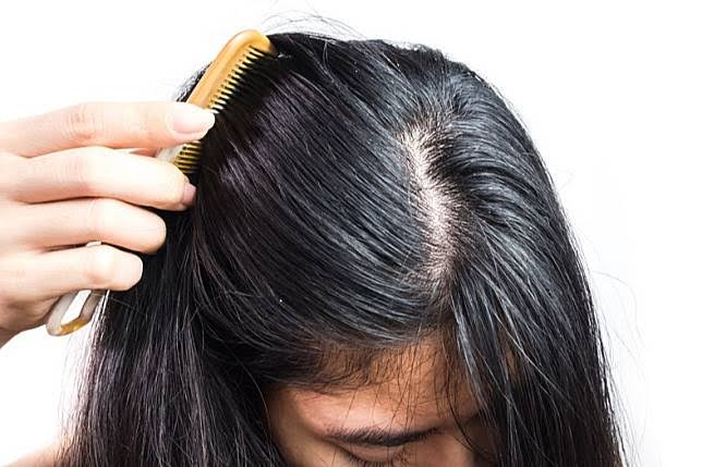 Rambut Lepek dan Berminyak? Atasi dengan 7 Tips Jitu Ini!