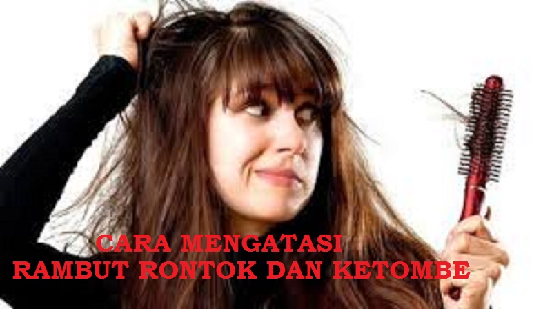 Tips Ampuh Mengatasi Rambut Rontok karena Ketombe: Kembalikan Kepercayaan Diri dengan Rambut Sehat dan Berkilau!