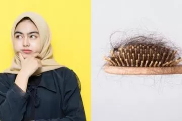 Rambut Rontok di Usia Muda: 12 Faktor yang Mungkin Tak Terduga!