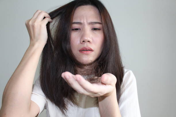 Rambut Rontok pada Wanita: 12 Faktor yang Perlu Diwaspadai