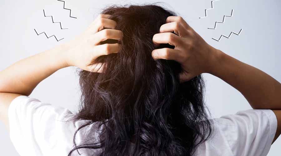 Penyebab Ketombe dan Rambut Rontok: 12 Faktor yang Harus Diwaspadai