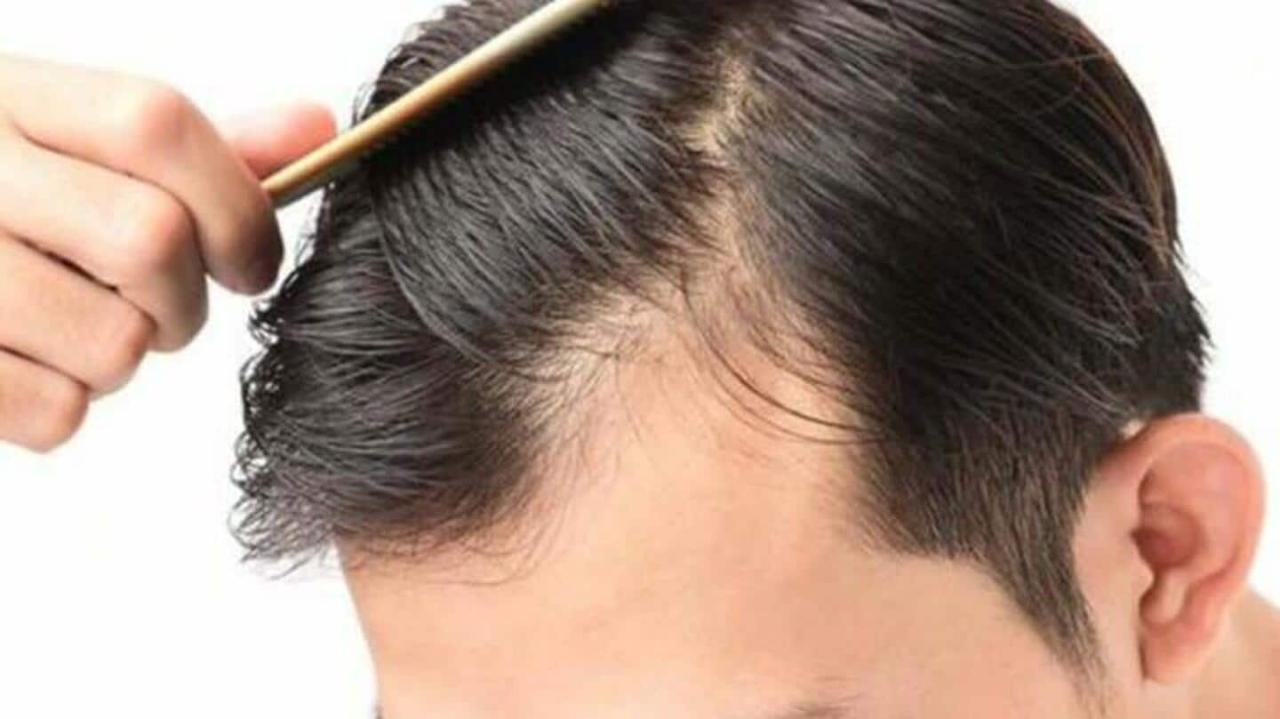 Penyebab Rambut Rontok Setelah Operasi: 12 Hal yang Tidak Anda Sadari