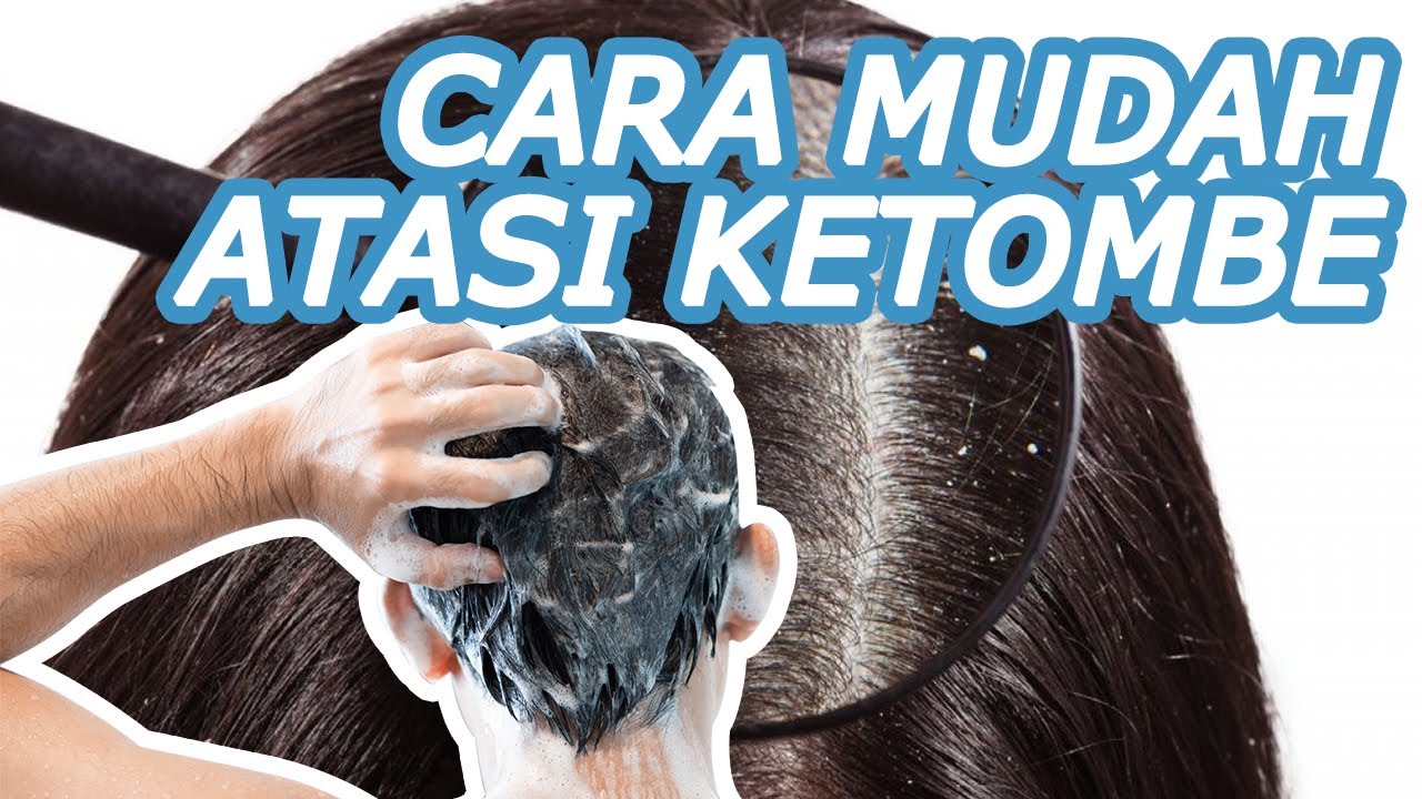 Cara Efektif Mengatasi Ketombe Akibat Perubahan Hormon: Panduan Lengkap untuk Rambut Sehat dan Bebas Ketombe