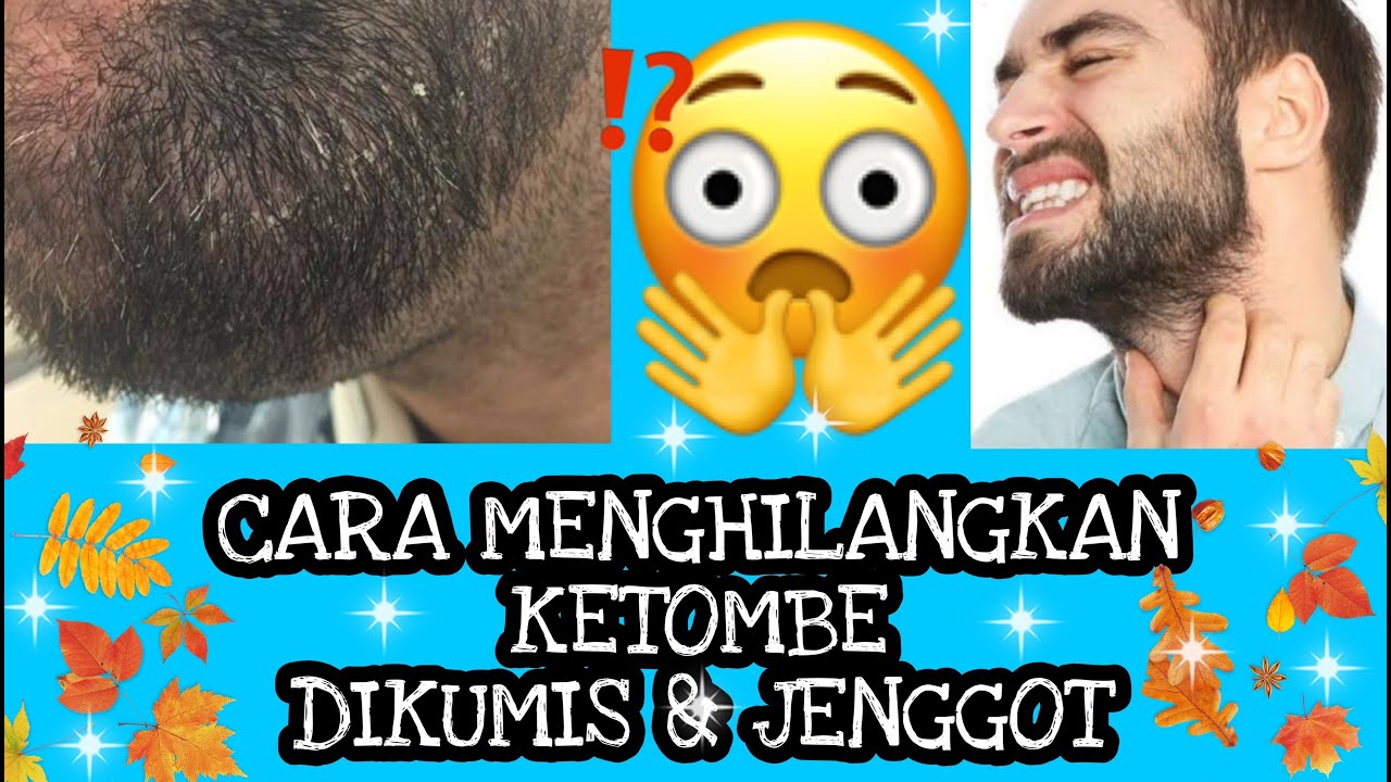 Cara Efektif Mengatasi Ketombe Akibat Perubahan Hormon: Panduan Lengkap untuk Rambut Sehat dan Bebas Ketombe