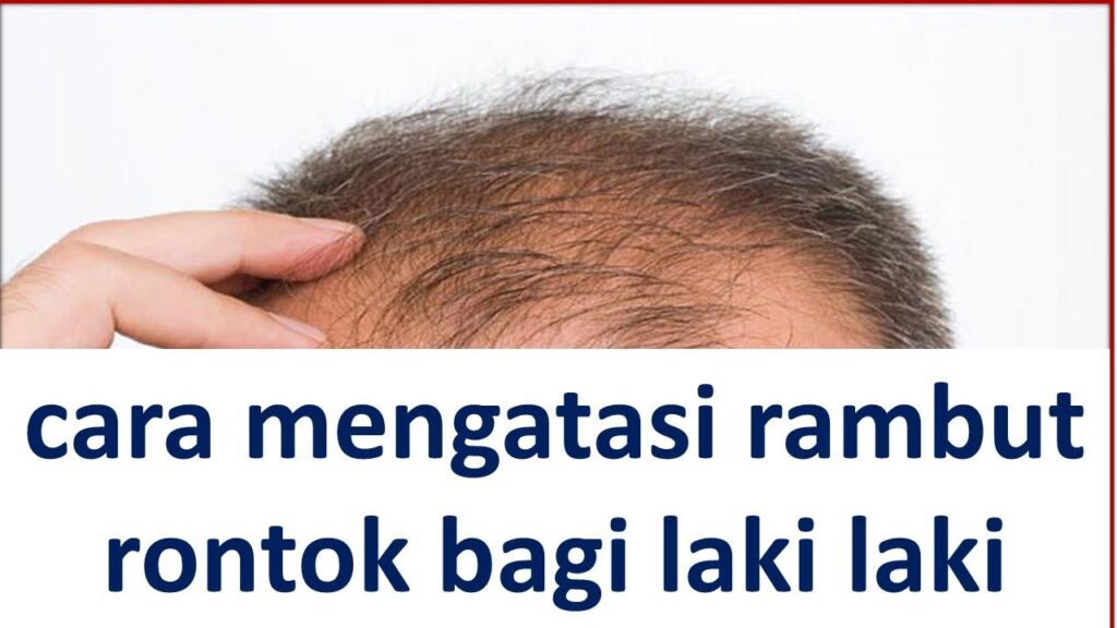 Rambut Rontok di Kepala? Tenang, Ini Solusi Efektif untuk Pria!