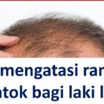 Rambut Rontok di Kepala? Tenang, Ini Solusi Efektif untuk Pria!