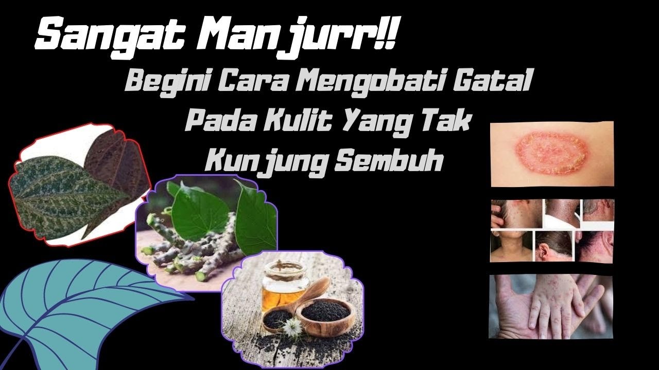 Kulit Kepala Gatal Tak Kunjung Sembuh? Waspadai Infeksi dan Atasi dengan Tepat!