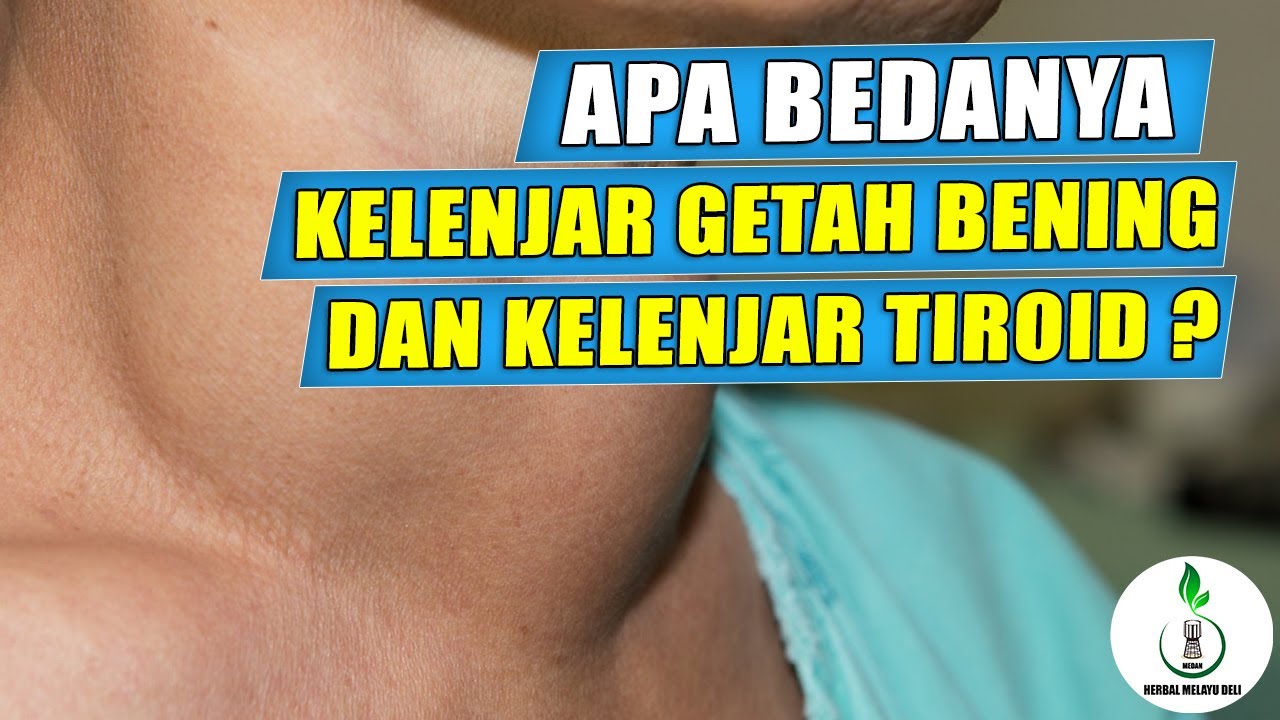 Bagaimana Masalah Tiroid Bisa Menyebabkan Kulit Kepala Gatal? Ini Penjelasannya