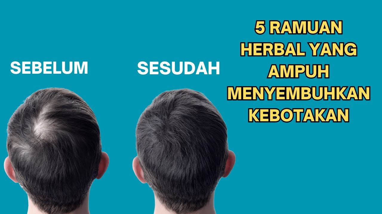 Rahasia Rambut Sehat Pria: Nutrisi yang Tak Tergantikan