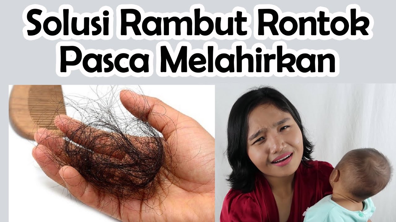 Solusi Aman Mengatasi Rambut Rontok pada Bayi: Tenang, Ini Bukan Masalah Besar!