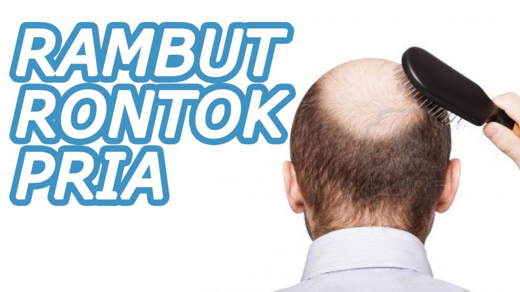 Solusi Praktis Mengatasi Rambut Rontok pada Pria: Kembalikan Kepercayaan Dirimu!