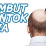 Solusi Praktis Mengatasi Rambut Rontok pada Pria: Kembalikan Kepercayaan Dirimu!