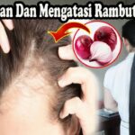 Cara Cepat Mengatasi Rambut Rontok: 12 Langkah Efektif yang Bisa Anda Lakukan