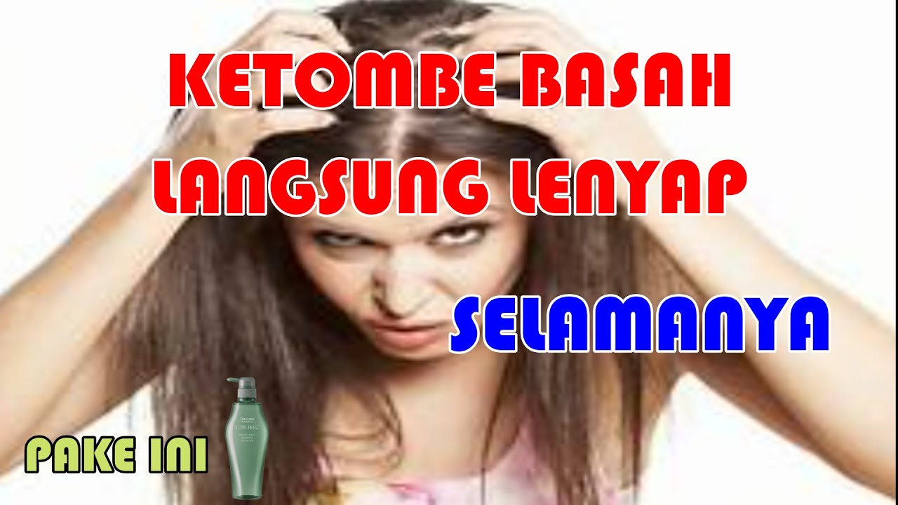 Cara Menghilangkan Ketombe dengan Cepat: 12 Tips Efektif untuk Hasil Maksimal