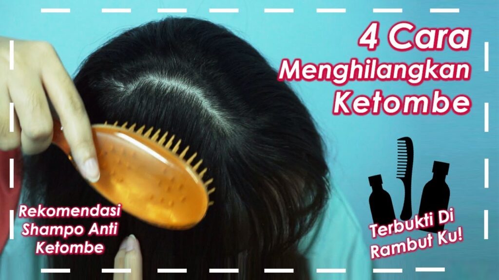 Cara Mengatasi Ketombe pada Rambut Keriting: 12 Tips untuk Rambut Bebas Ketombe