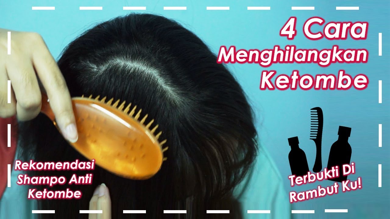 Cara Mengatasi Ketombe pada Rambut Keriting: 12 Tips untuk Rambut Bebas Ketombe