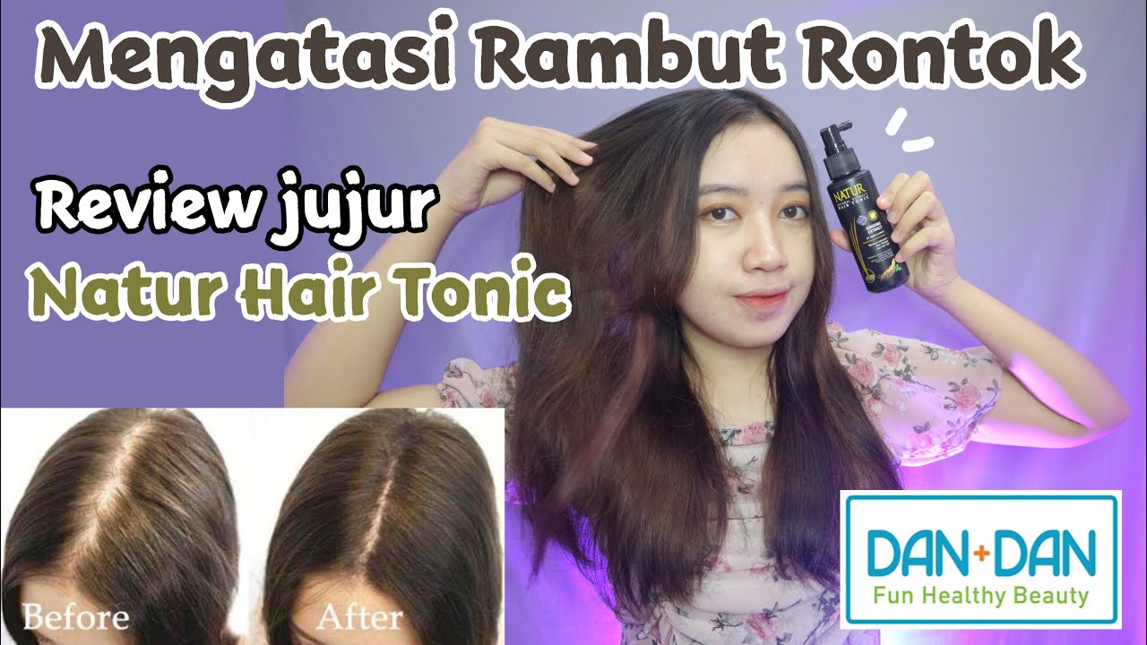 Rambut Rontok Parah? Tenang, Ada Solusinya!