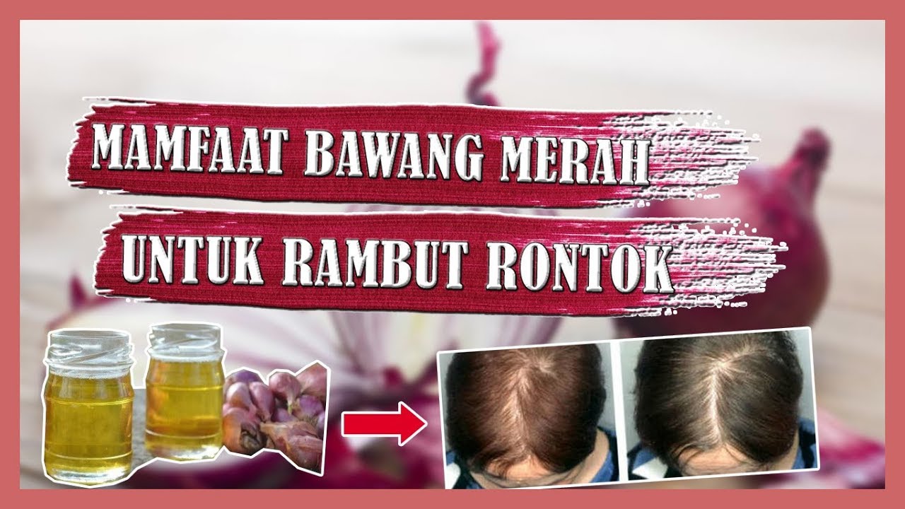 Rambut Rontok? Coba Atasi dengan Bawang Merah!