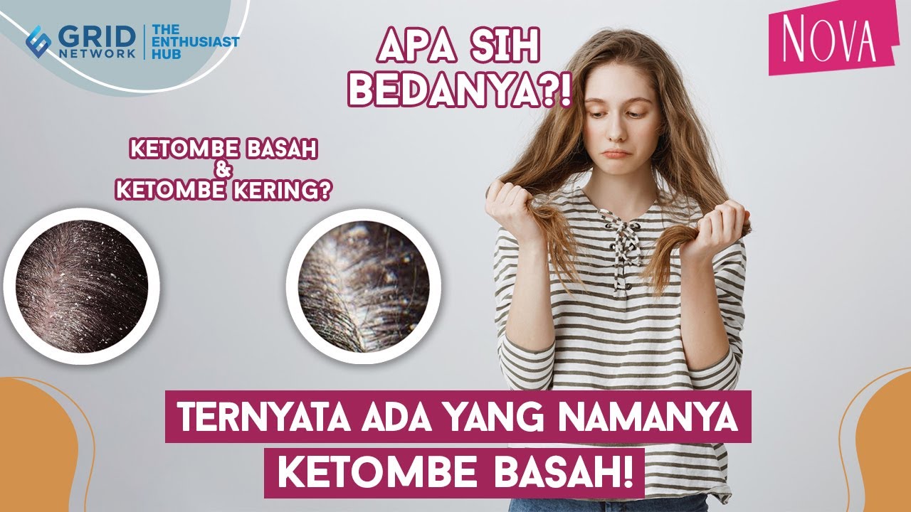 Apa Penyebab Ketombe? Ini Jawabannya!