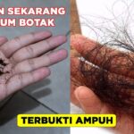 Ucapkan Selamat Tinggal Pada Rambut Rontok: 12 Resep Alami Minyak Kelapa yang Terbukti Efektif