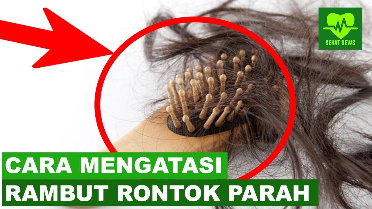 Cara Efektif Mengatasi Rambut Rontok dalam 1 Minggu: Benarkah Itu Mungkin?