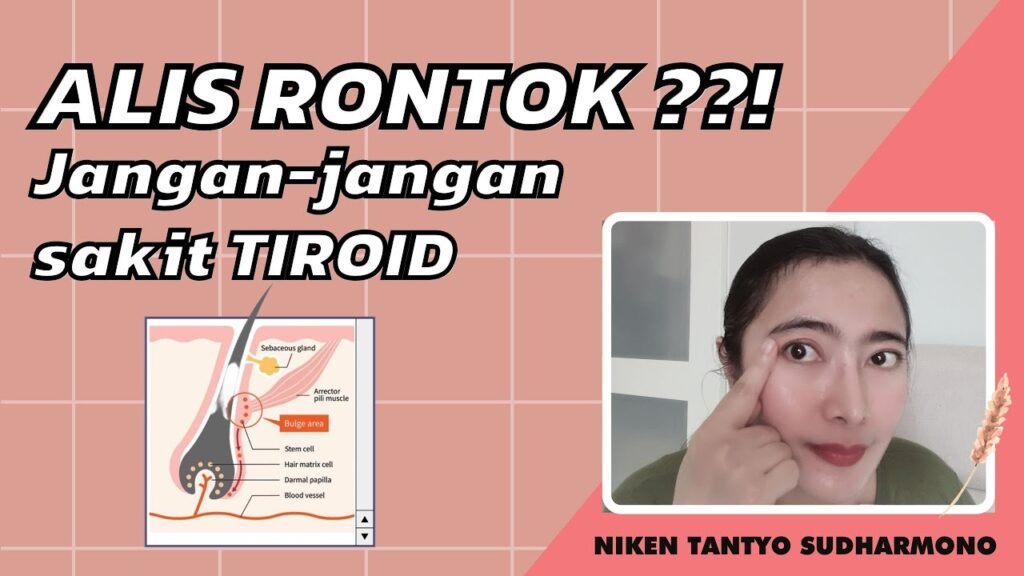 Rambut Rontok? Waspadalah, Tiroid Mungkin Bermasalah!