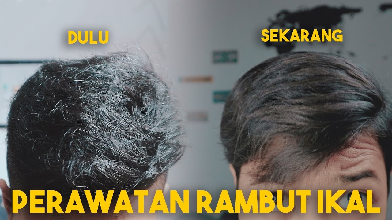 Rambut Ikal Bisa Lurus Permanen? Mitos atau Fakta?