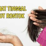 12 Cara Mengatasi Rambut Rontok Parah Secara Alami: Kembalikan Kepercayaan Dirimu!