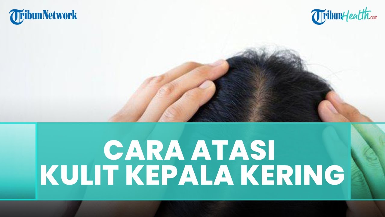 Atasi Kulit Kepala Kering dengan Sentuhan Alami: Rahasia Rambut Sehat dan Berkilau