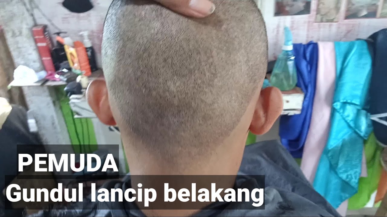 Apakah Rambut Gundul Bisa Tumbuh Kembali? Menyingkap Misteri Kebotakan