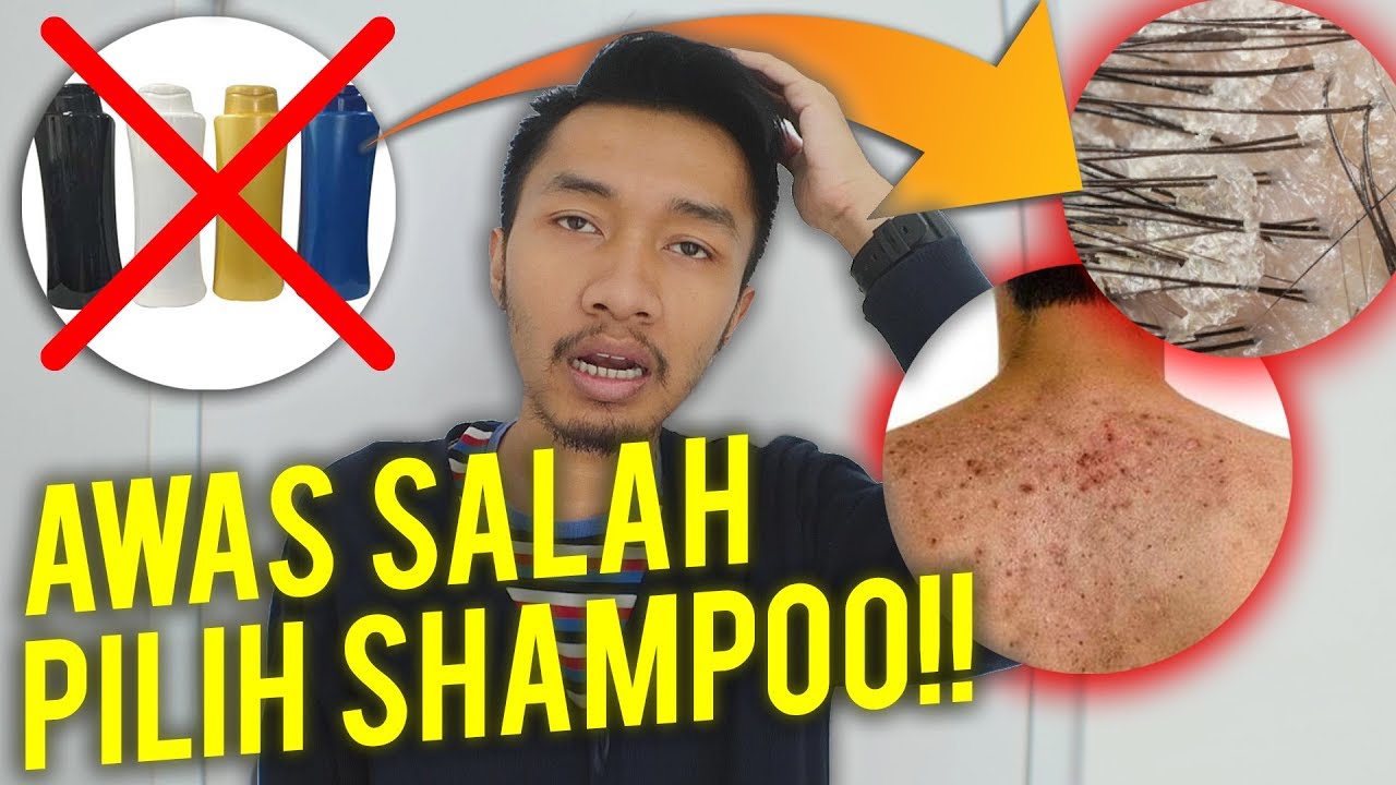 Gaya Rambut 2024: Tips Mengatasi Ketombe Setelah Ganti Shampoo