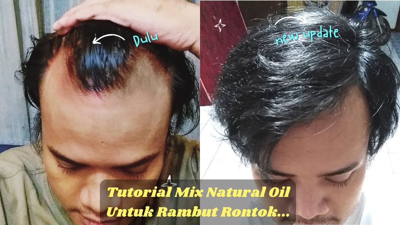 Atasi Rambut Rontok dengan Aromaterapi: Rahasia Minyak Esensial untuk Rambut Sehat