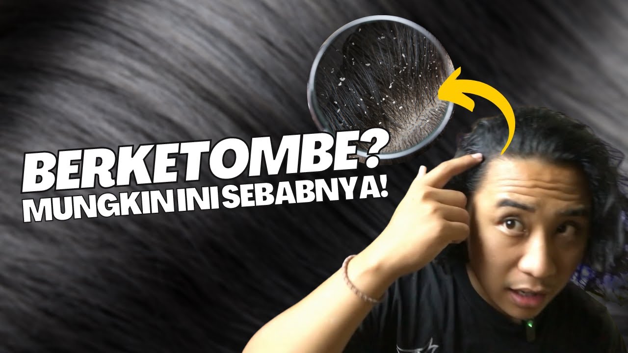 Rambutmu Gatal dan Berketombe? Ini Dia Tips Jitu Mengatasinya!