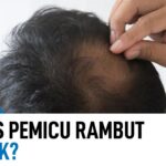 Rambut Rontok? Waspadai Anemia!