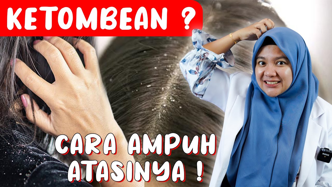 Cara Ampuh Mengatasi Ketombe pada Orang Tua dengan Bahan Alami