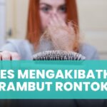 Apakah Rambut Rontok Bisa Dihentikan dengan Diet Khusus?